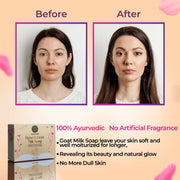 Sugandhim – Rose & Goat Milk